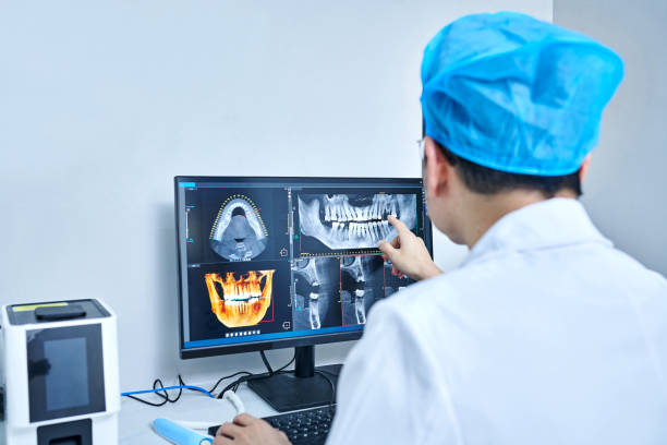 Best Emergency Wisdom Teeth Removal in Joshua Tree, CA